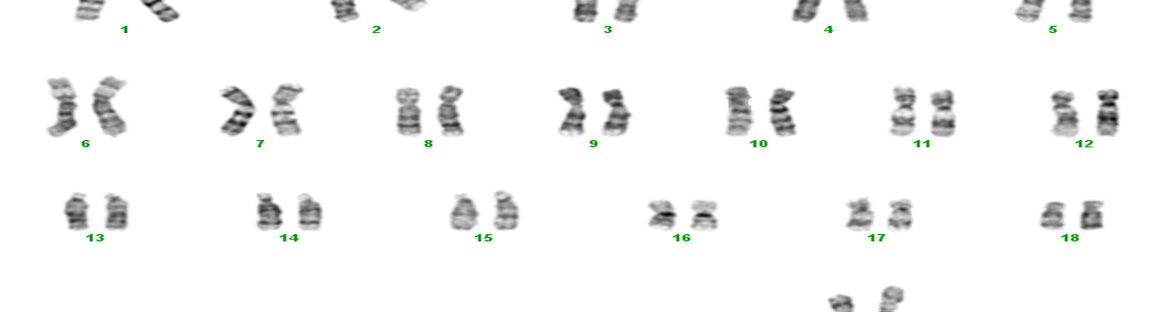 Karyotype